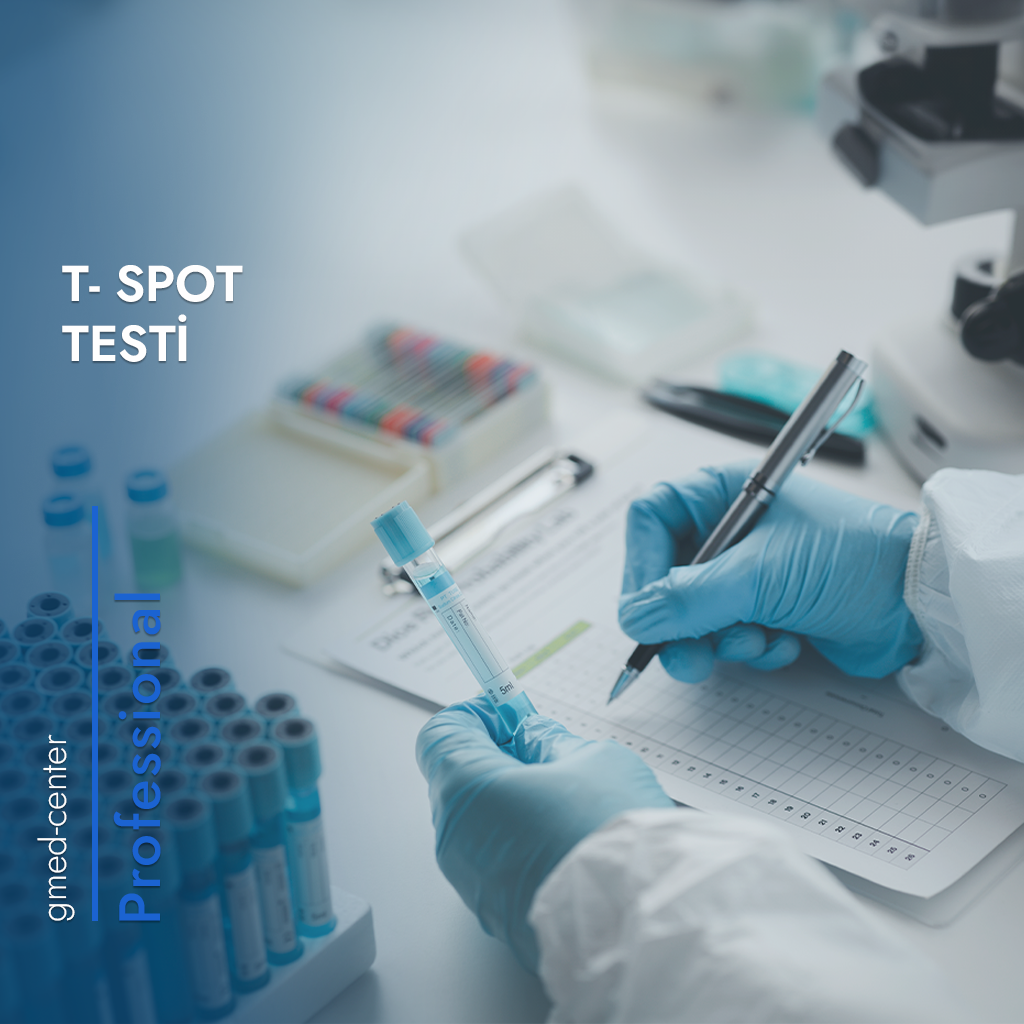 T-Spot Testi